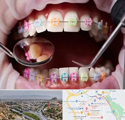 متخصص ارتودنسی در معالی آباد شیراز