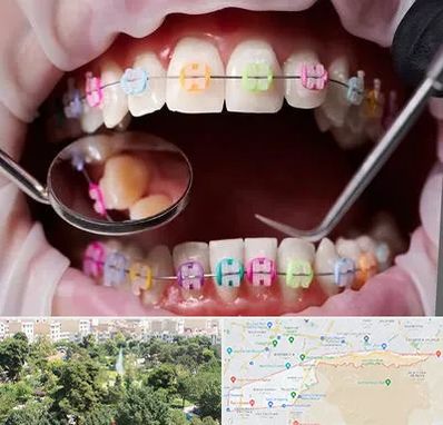 متخصص ارتودنسی در منطقه 13 تهران