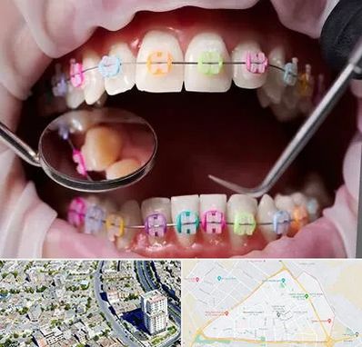 متخصص ارتودنسی در قاسم آباد مشهد