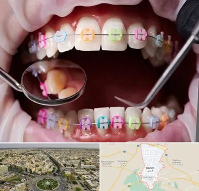 متخصص ارتودنسی در قزوین