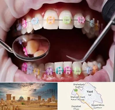 متخصص ارتودنسی در یزد
