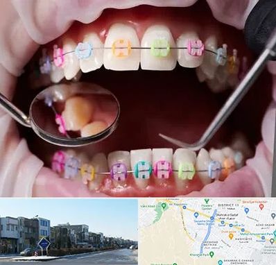 متخصص ارتودنسی در شریعتی مشهد