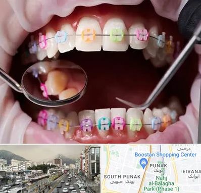 متخصص ارتودنسی در پونک 
