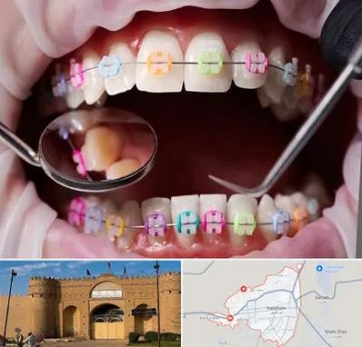 متخصص ارتودنسی در ایرانشهر