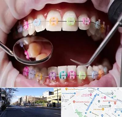 متخصص ارتودنسی در خیابان ملاصدرا شیراز