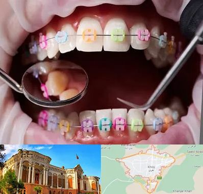 متخصص ارتودنسی در خوی