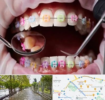 متخصص ارتودنسی در خیابان ارم شیراز