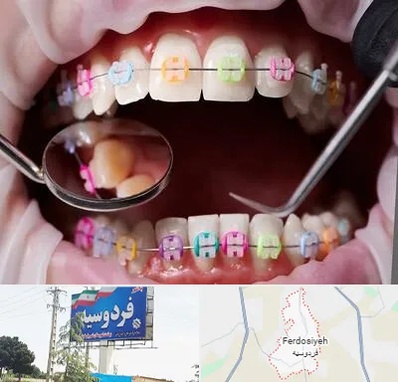 متخصص ارتودنسی در فردوسیه شهریار