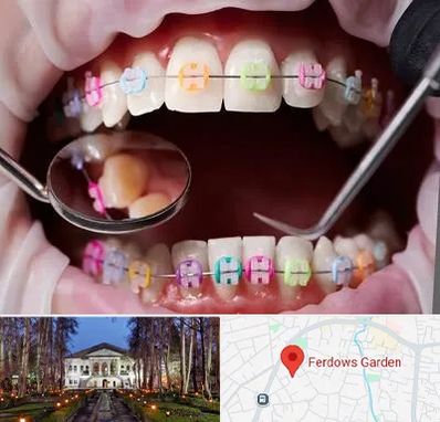 متخصص ارتودنسی در باغ فردوس