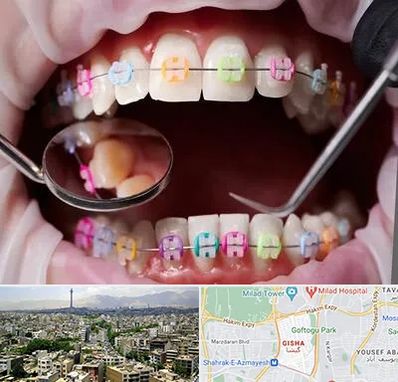متخصص ارتودنسی در گیشا 