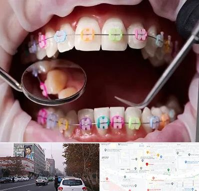 متخصص ارتودنسی در کارگر شمالی