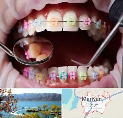 متخصص ارتودنسی در مریوان