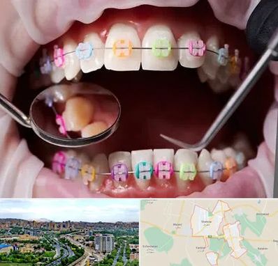 متخصص ارتودنسی در شهریار