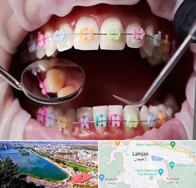 متخصص ارتودنسی در لاهیجان