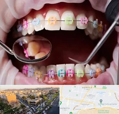 متخصص ارتودنسی در تهرانپارس 