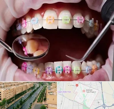 متخصص ارتودنسی در فاز سه اندیشه