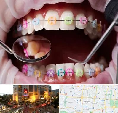 متخصص ارتودنسی در جنت آباد تهران 