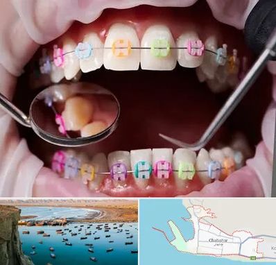 متخصص ارتودنسی در چابهار