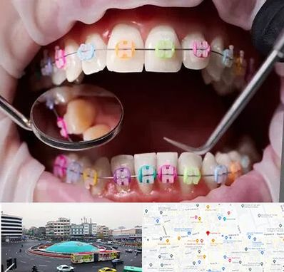 متخصص ارتودنسی در میدان انقلاب