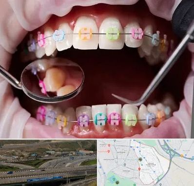 متخصص ارتودنسی در یاغچیان تبریز