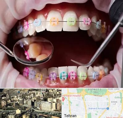 متخصص ارتودنسی در مرزداران 