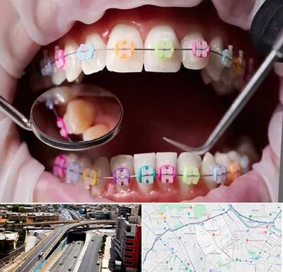 متخصص ارتودنسی در ستارخان شیراز