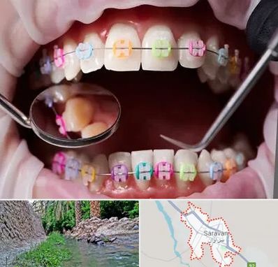 متخصص ارتودنسی در سراوان