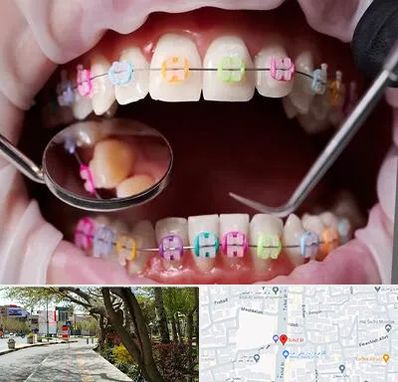 متخصص ارتودنسی در خیابان توحید اصفهان