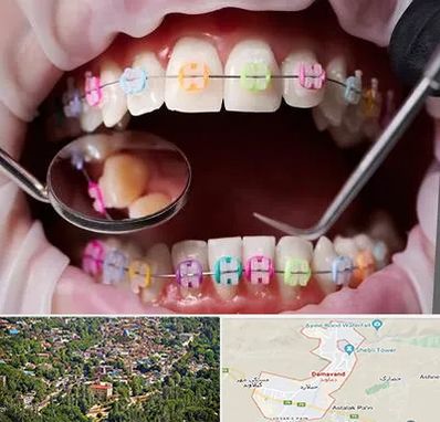 متخصص ارتودنسی در دماوند