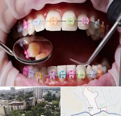 متخصص ارتودنسی در اوین