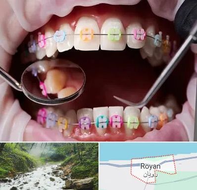 متخصص ارتودنسی در رویان