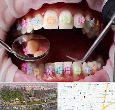 متخصص ارتودنسی در آیت الله کاشانی