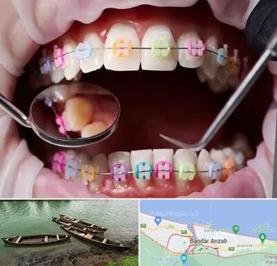 متخصص ارتودنسی در بندر انزلی