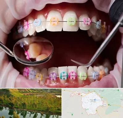 متخصص ارتودنسی در بهبهان