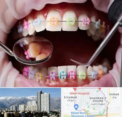 متخصص ارتودنسی در شهرک غرب 