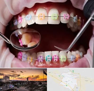 متخصص ارتودنسی در قوچان