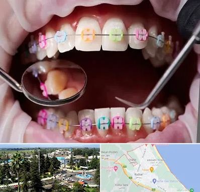 متخصص ارتودنسی در رودسر