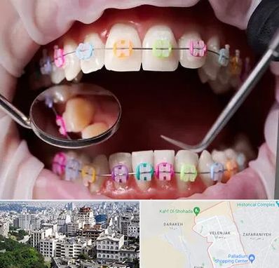 متخصص ارتودنسی در ولنجک 