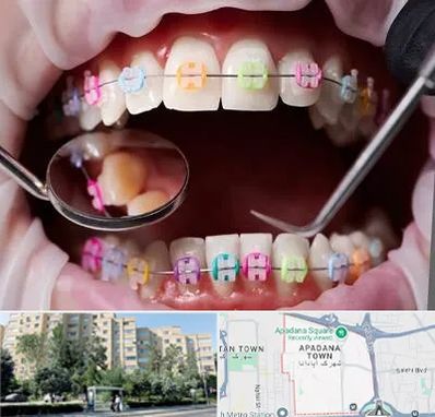 متخصص ارتودنسی در آپادانا