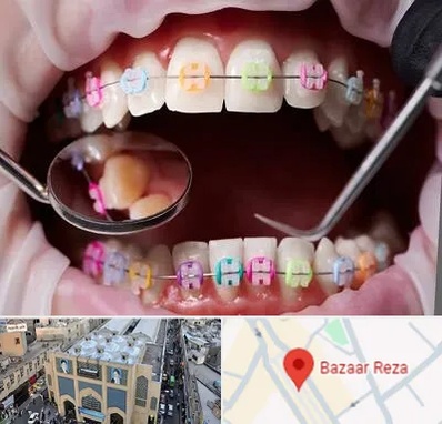 متخصص ارتودنسی در بازار رضا مشهد