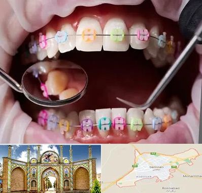 متخصص ارتودنسی در سمنان