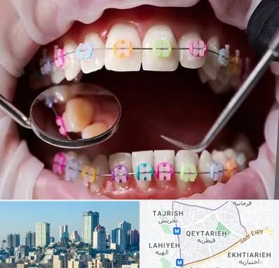 متخصص ارتودنسی در قیطریه 