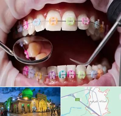 متخصص ارتودنسی در آستانه اشرفیه