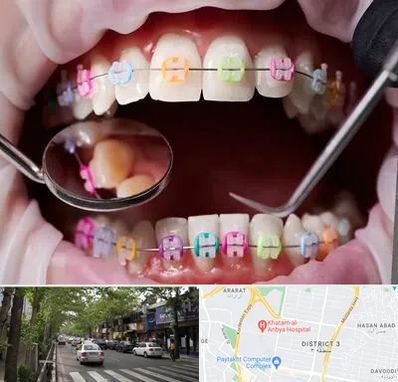 متخصص ارتودنسی در ظفر 