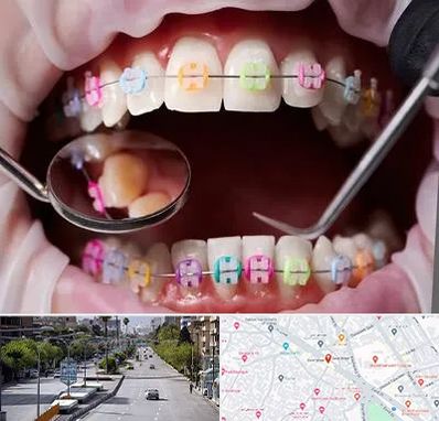 متخصص ارتودنسی در خیابان زند شیراز