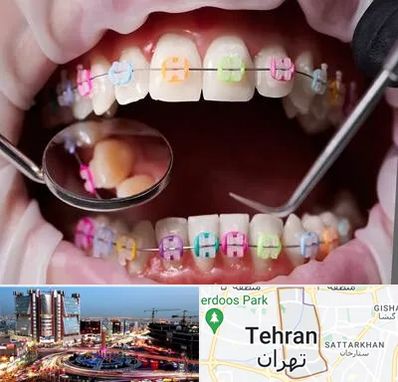 متخصص ارتودنسی در صادقیه 