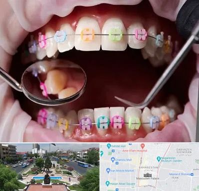 متخصص ارتودنسی در بهارستان 