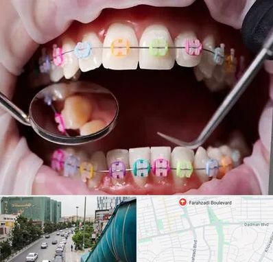 متخصص ارتودنسی در بلوار فرحزادی