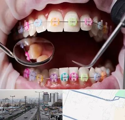 متخصص ارتودنسی در بلوار ارتش