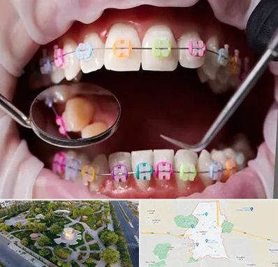 متخصص ارتودنسی در کاشمر